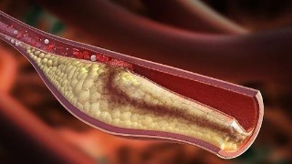 死亡超14万,佩洛西称“特朗普病毒”正在残害美国|JDB电子游戏官网(图4) JDB电子游戏官网